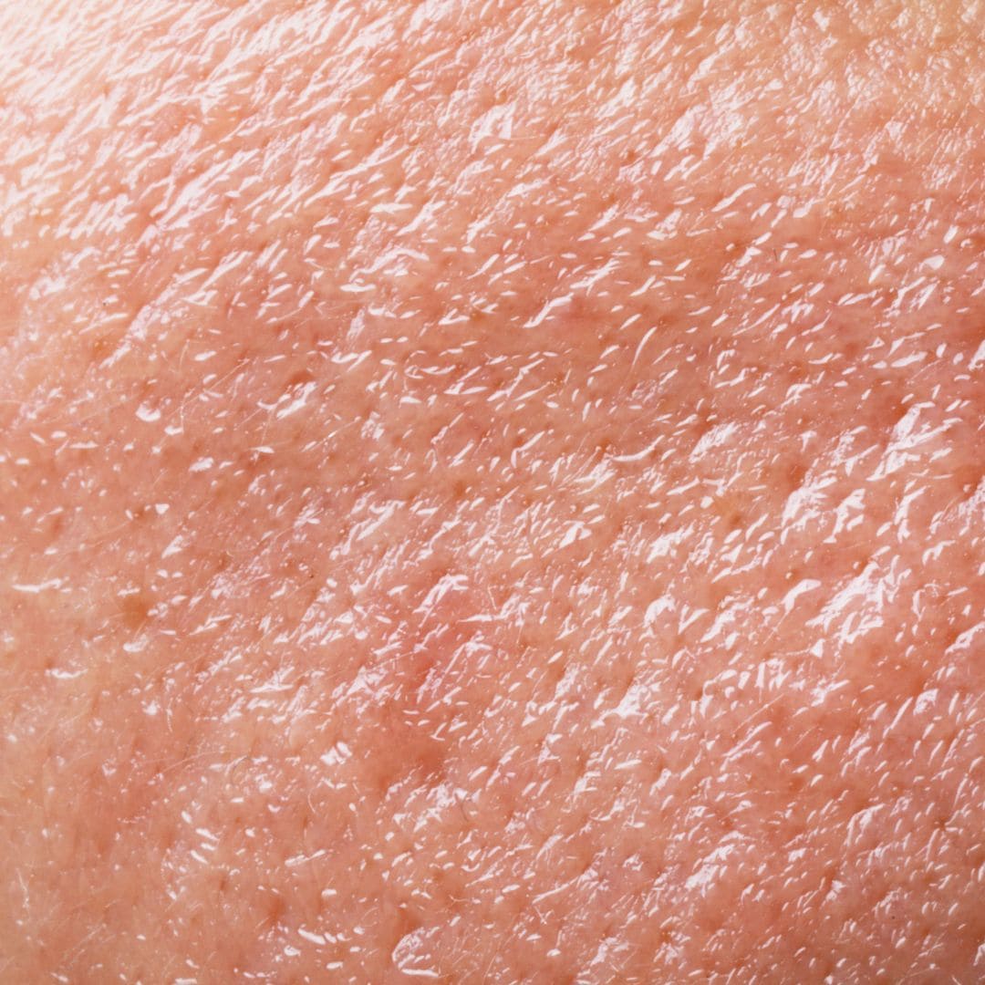 To Moisturize or Not_ Understanding Oily Skin and Moisturization 2