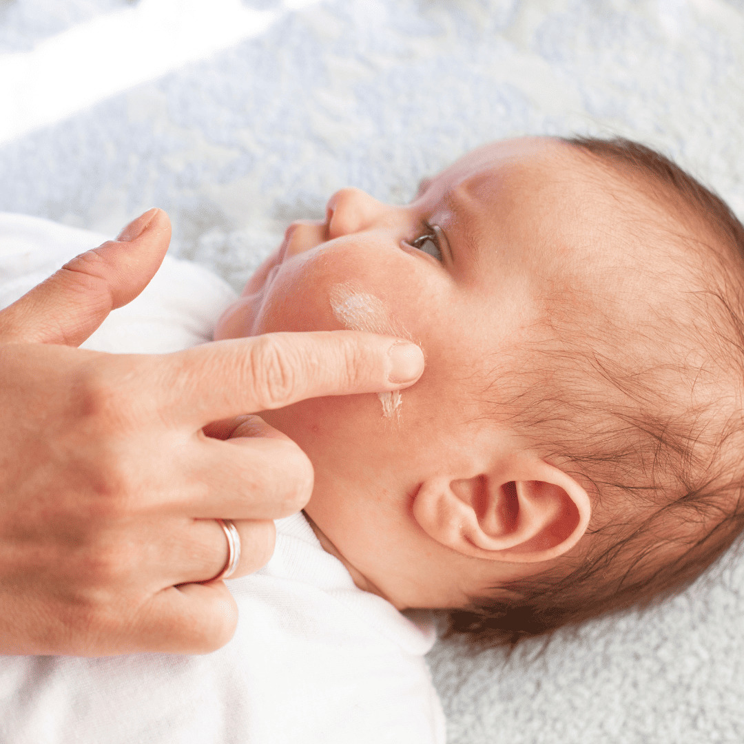 Hydration de la peau de bébé Hydrater régulièrement la peau à tendance eczéma de bébé. Appliquez un soin émollient matin et soir pour renforcer la barrière cutanée et réduire la sécheresse de la peau à tendance eczéma.